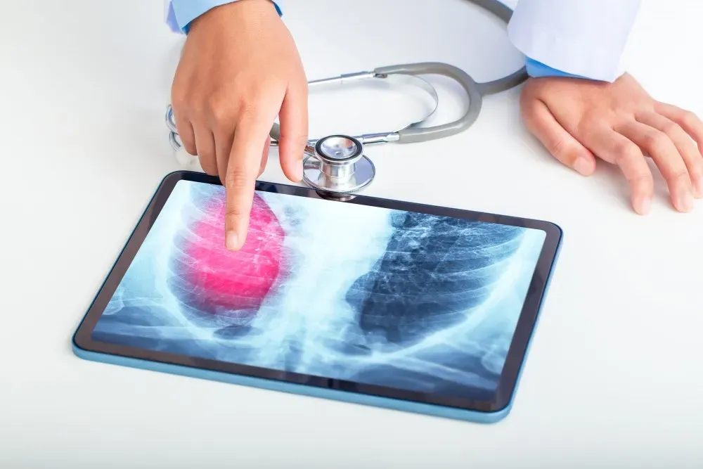 What’s the Difference Between Bronchitis and Pneumonia?
