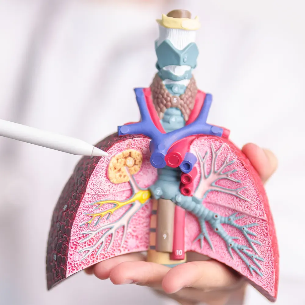 Bronchiectasis