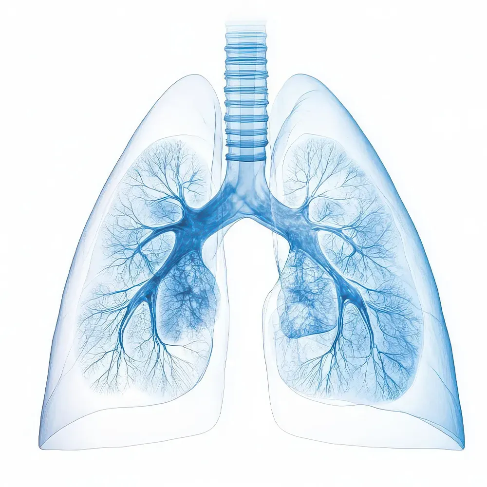 Pleural Effusion